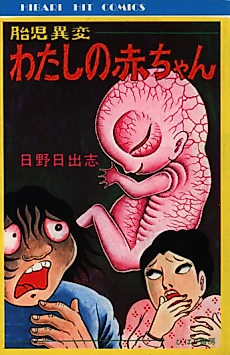 Cover image for Unusual Fetus: My Baby